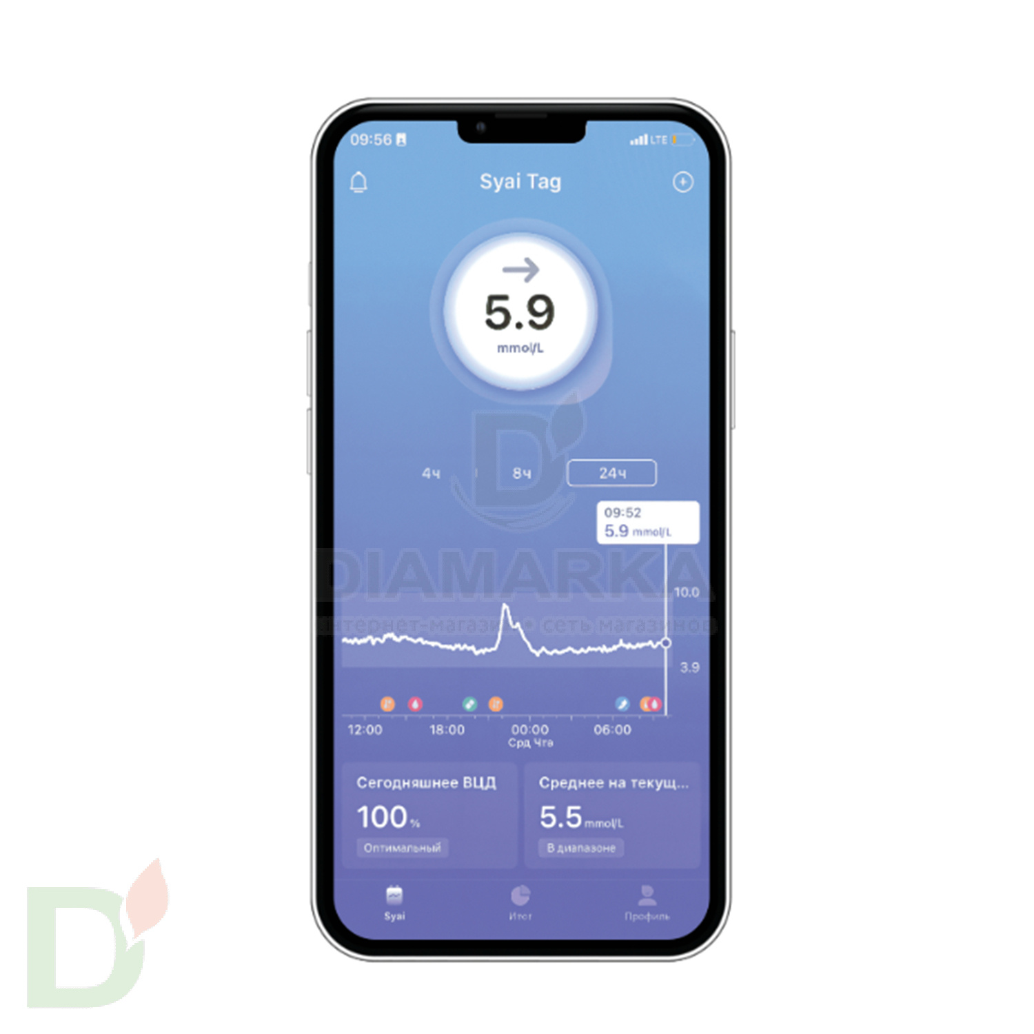 Сенсор (датчик) Syai X1