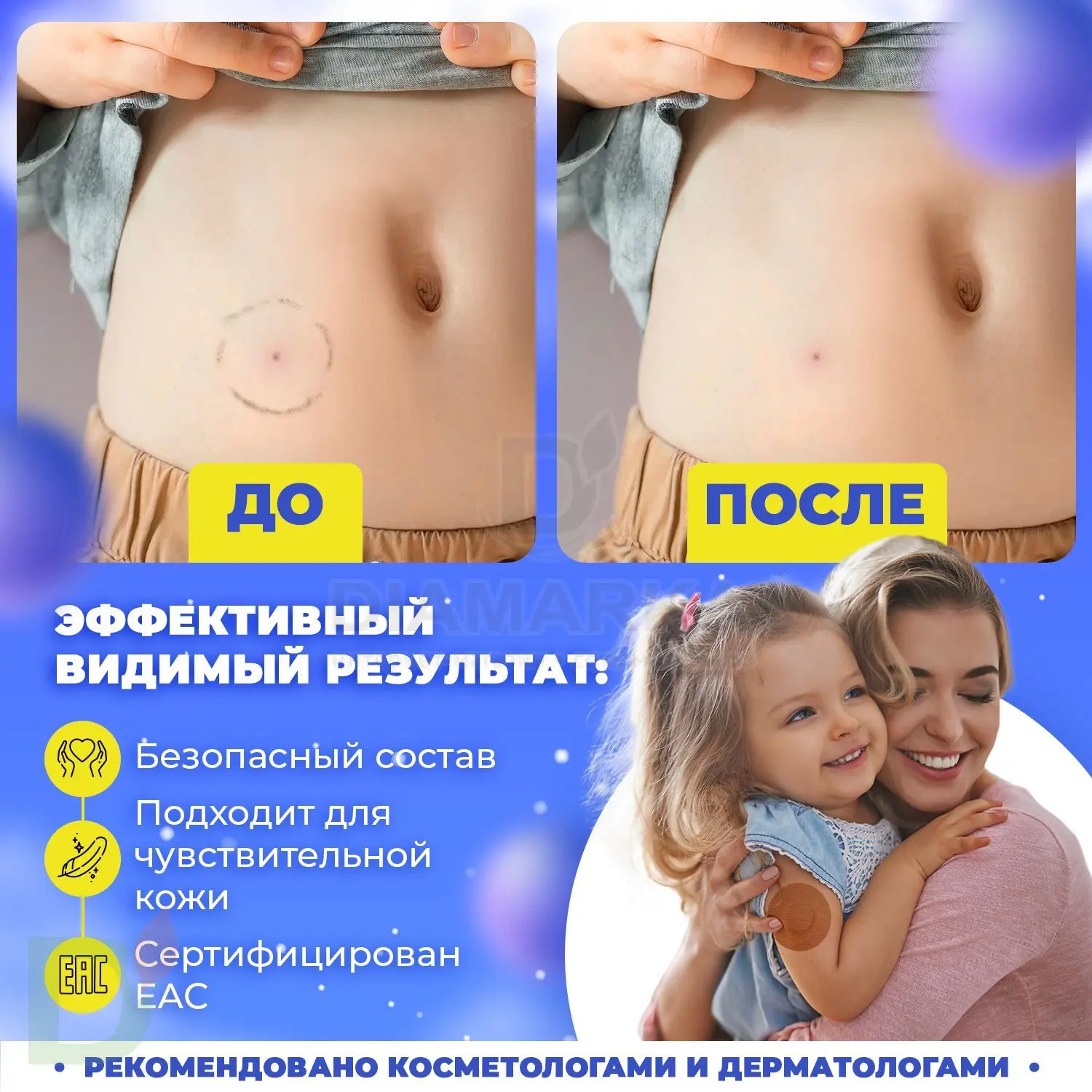 Ремувер 4SKINcare для удаления FreeStyle Libre Лимонная карамель, 115 мл